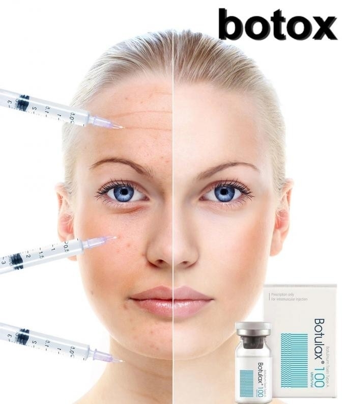 100iu Face Thinning Botox Botulinum Toxin Botulax 200 Units Type A Injection