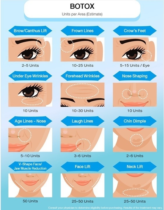 100iu Face Thinning Botox Botulinum Toxin Botulax 200 Units Type A Injection